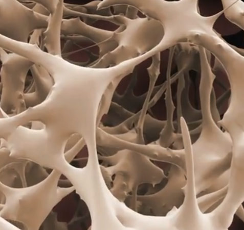 Bones