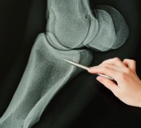 Bone Image