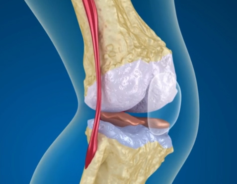 Cartilage