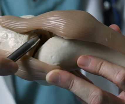 Knee Repair Model